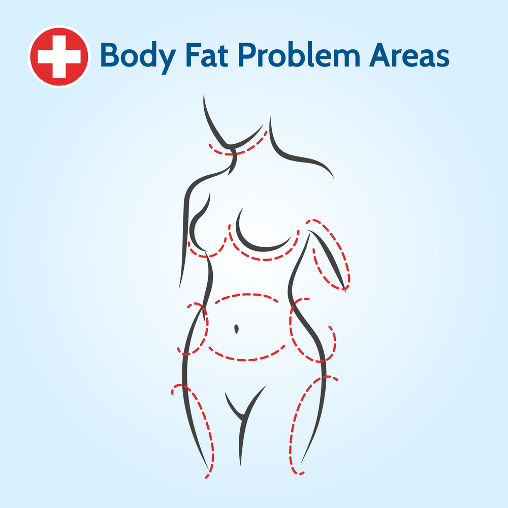 Body fat problem area liposuction korea