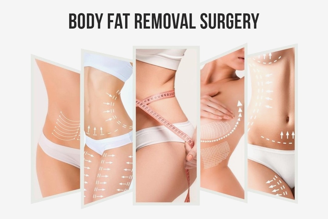 Full Body Fat Removal Surgery in South Korea