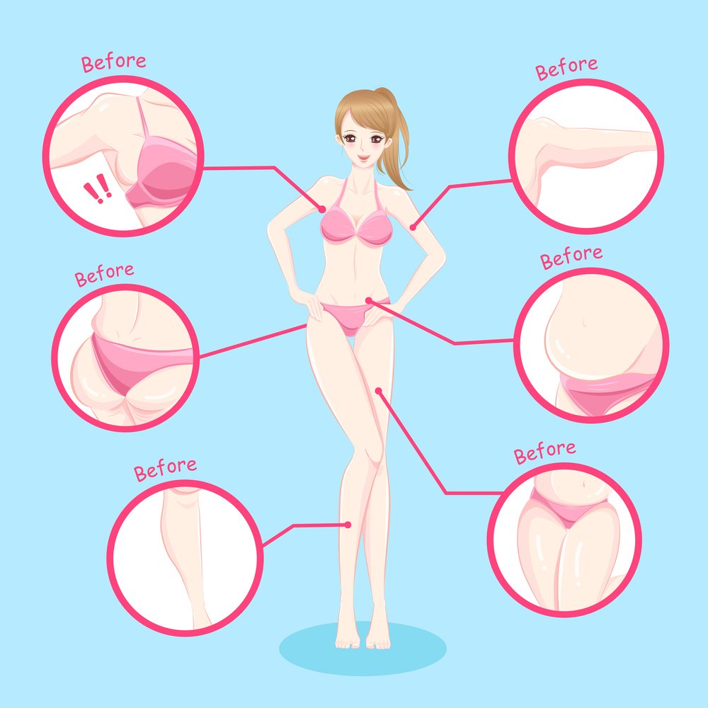 Liposuction Seoul Korea - Body Contouring