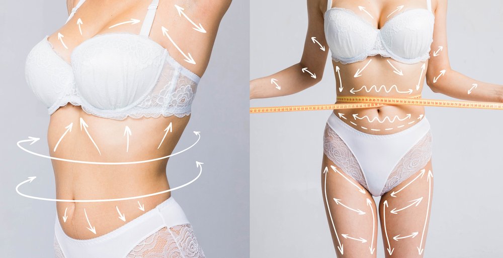 Laser Assisted Liposuction in korea