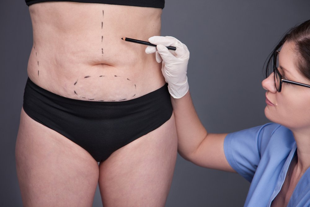 Power Assisted Liposuction in korea