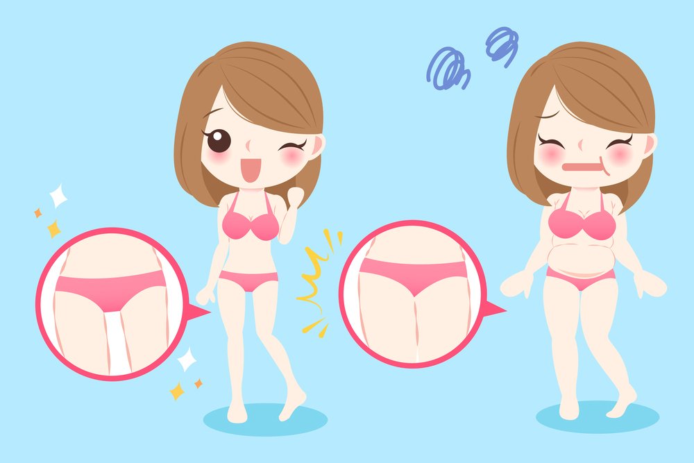 Inner Thigh Liposuction Overview