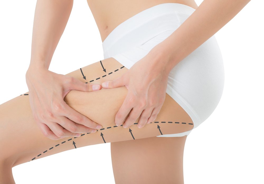 Shop By - Shop By Surgery - Liposuction - Thigh Liposuction